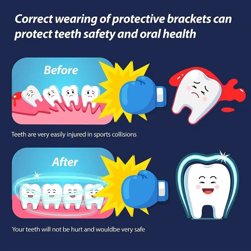 Miniatura 3 de Youth Mouth Guard Football Sport Mouthguard, Premium Quality No Boiling Required，Suitable for Basketball, Wrestling, Taekwondo, Jujitsu and Karate