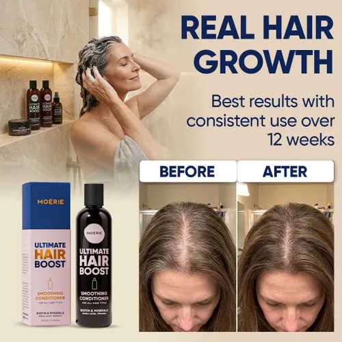 Miniatura 4 de Moerie Acondicionador para el crecimiento del cabello para hombres y mujeres, solución de pérdida de cabello con biotina y romero, acondicionador