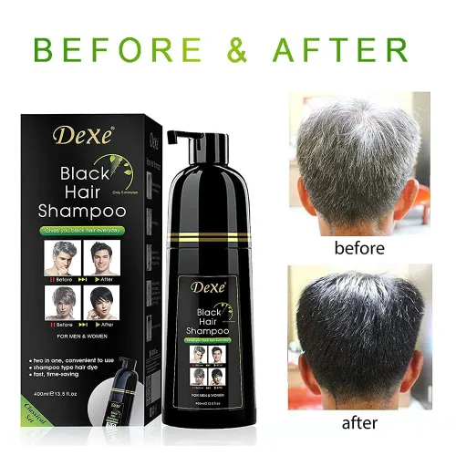 Miniatura 3 de Vedora Champú instantáneo para cabello negro, 13.5 fl oz, champú semipermanente DeXe negro tinte para cabello natural, dura 30 días, fórmula