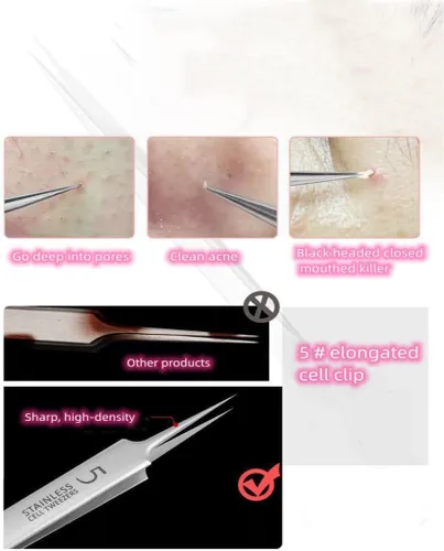 Miniatura 5 de Pinzas profesionales para eliminar puntos negros, kit de eliminación de acné, herramienta para reventar espinillas, clip para espinillas, clip
