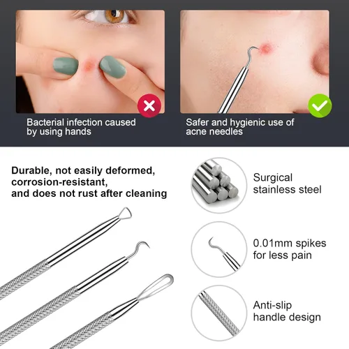 Miniatura 6 de Kit de eliminación de puntos negros, extractor de comedona de acné de acero inoxidable con lupa 10X y 20 almohadillas de alcohol al 75%, eliminación
