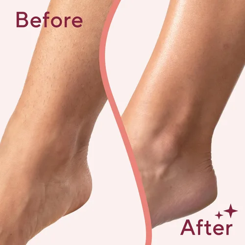Miniatura 8 de Finishing Touch Flawless Legs, Maquinilla de Afeitar Eléctrica para Mujeres, Removedor de Vello de Piernas con Cabezal Pivotante y Luz LED