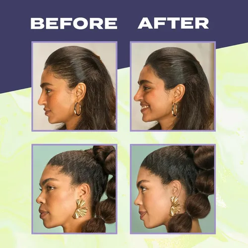 Miniatura 11 de Toppik Hair Building Fibers, Fill In Fine or Thinning Hair Instantly Thicker, Fuller Looking Hair 9 Shades,4 size options