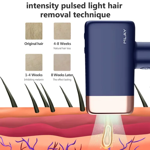 Miniatura 3 de MLAY Dispositivo de depilación IPL, protección de enfriamiento de hielo con láser permanente para todo el cuerpo, removedor de vello para uso