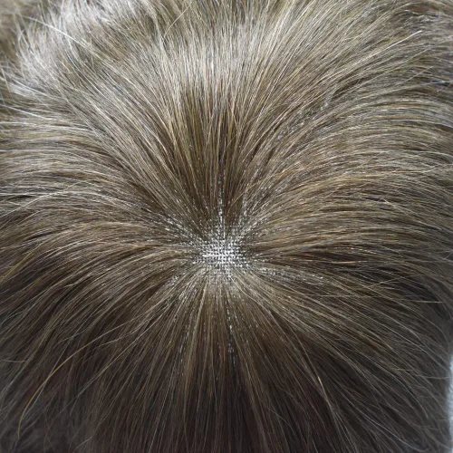 Miniatura 6 de Toupee - Sistema de reemplazo de cabello para hombre, encaje frontal suizo, nudo blanqueado, pieza de cabello humano natural