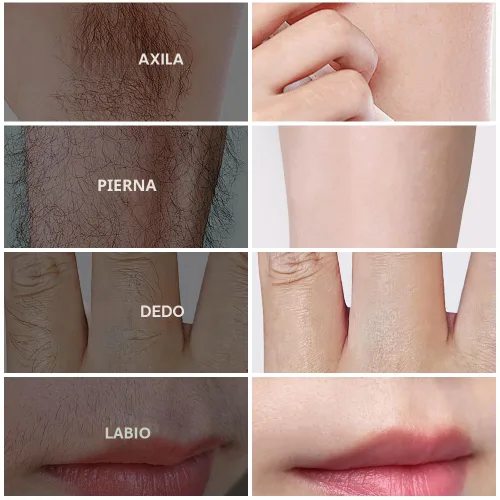 Miniatura 7 de PHOFAY Crema depilatoria para hombres y mujeres, piel sensible, de acción rápida, recomendada por dermatólogos, con aloe y ácido hialurónico