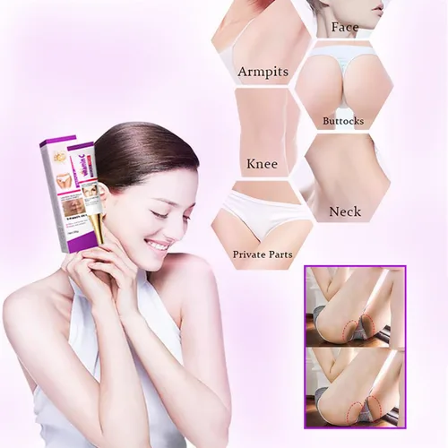 Miniatura 8 de Removedor de manchas oscuras para rostro, crema de niacinamida Manchas Oscuras, 0.71 oz Crema Premium Manchas Edad, manchas oscuras en manos