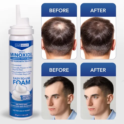 Miniatura 5 de Hair Regen Minoxidil Foam para hombres 5% - Tratamiento de crecimiento del cabello para hombres para él - Espuma tópica Minoxidil para hombres