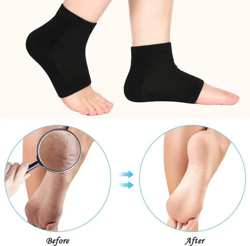 Miniatura 5 de 3 pares de calcetines hidratantes, calcetines de talón de gel suaves y ventilados, calcetines de punta abierta para piel seca dura y agrietada