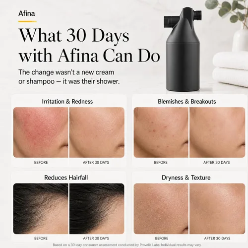 Miniatura 5 de Filtro de ducha Afina para agua dura - Elimina el 99% del cloro, sustancias nocivas y metales pesados - Mejora tu piel y cabello (Negro) Reduce