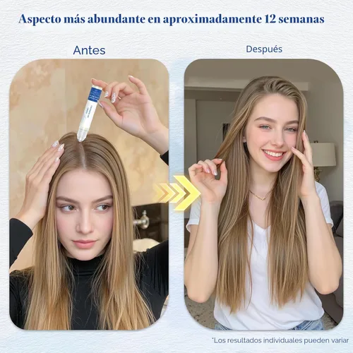 Miniatura 5 de Suero para el crecimiento del cabello roll-on con romero, ayuda a apoyar la apariencia del cabello más grueso y lleno, limpio y no graso