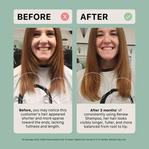 Miniatura 6 de ACTIIV Renew Travel Duo (unisex) Apoya la salud del cuero cabelludo y la apariencia de un cabello más completo, de aspecto más saludable, hidrata