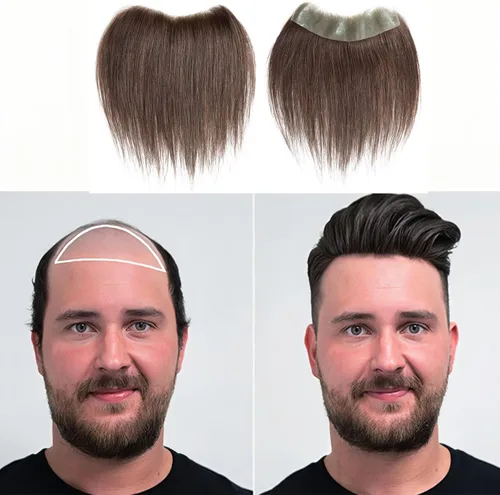 Miniatura 14 de Extensión frontal de cabello rubio claro para hombres, extensión de cabello lacio con pérdida de línea de cabello humano con cinta adhesiva