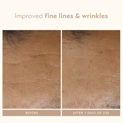 Miniatura 4 de SHANI DARDEN SKIN CARE - Varita para esculpir el rostro, dispositivo de reafirmación y apriete del cuello, dispositivo de ondas de sonido