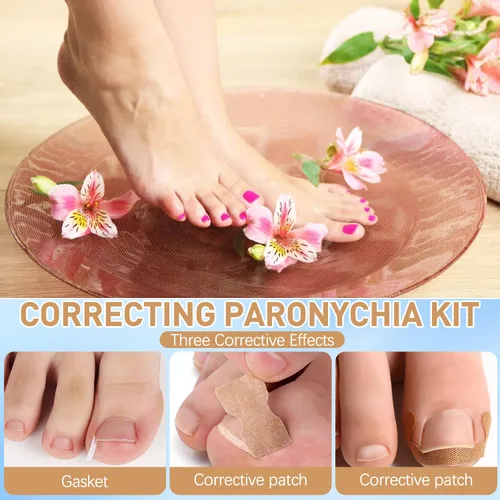 Miniatura 4 de Juego de corrector profesional de uñas encarnadas con tiras correctoras, kit de eliminación de uñas encarnadas, juego de herramientas de pedicura