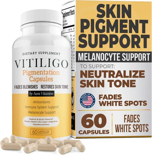 Dermawonder - Cápsulas de vitiligo (60 unidades) Suplemento eficaz de vitíligo, reduce las manchas blancas y mejora el apoyo de la pigmentación de