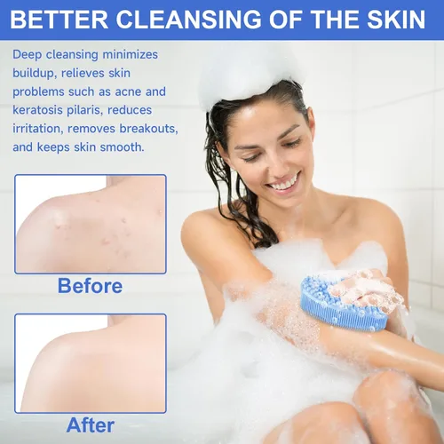 Miniatura 4 de Metene cepillo exfoliante corporal de silicona con asa, cepillo corporal para hombres y mujeres, esponja de silicona para la ducha, silicona suave