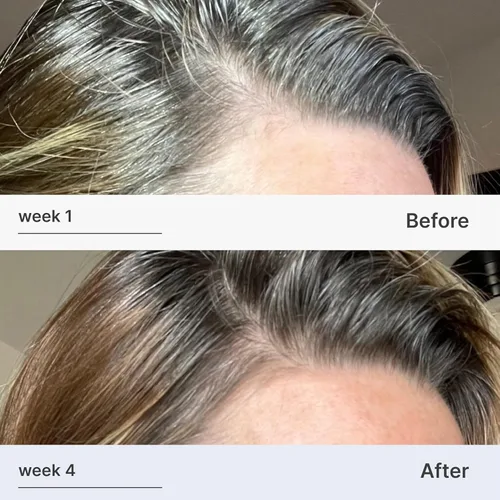 Miniatura 3 de Better Not Younger Suero fortificante para el cabello y el cuero cabelludo para adelgazar y envejecer el cabello, suero para cabello más fuerte