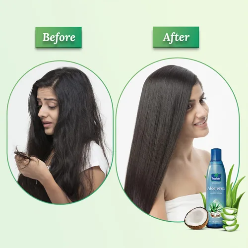 Miniatura 2 de Parachute Advansed Aceite de coco enriquecido con aloe vera para cabello fuerte, suave y sedoso, nutrición profunda y acondicionamiento, todo tipo