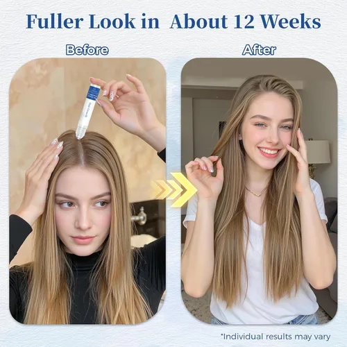 Miniatura 5 de Suero para el crecimiento del cabello roll-on con romero, ayuda a apoyar la apariencia del cabello más grueso y lleno, limpio y no graso