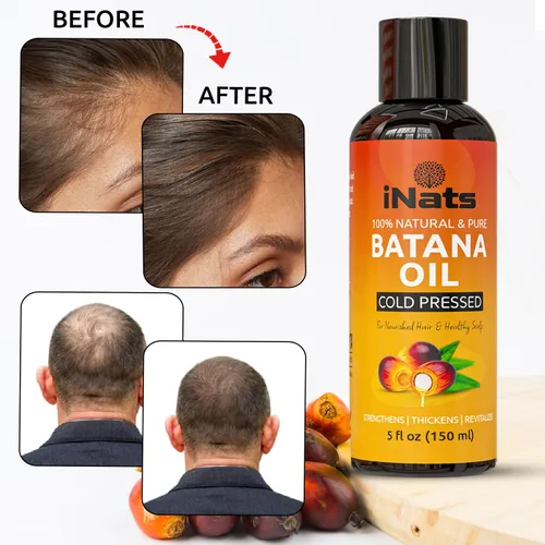 Miniatura 4 de Aceite de batana crudo prémium para el crecimiento del cabello (5 onzas líquidas) – Dr. Sebi 100% puro y aceite de crecimiento del cabello Batana