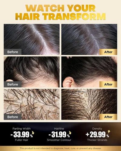 Miniatura 3 de Juego de champú y acondicionador de biotina para crecimiento del cabello con infusión de tripéptido, tratamiento hidratante voluminizador