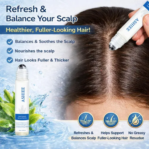 Miniatura 3 de Roll-On para el crecimiento del cabello con romero y jengibre, suero de crecimiento del cabello enrollable de precisión para adelgazar el cabello