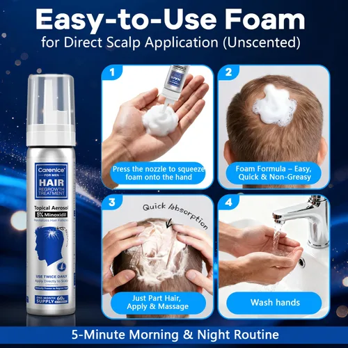 Miniatura 4 de Espuma tópica de minoxidil al 5 %, aerosol de minoxidil para hombres, impregnado con biotina, tratamiento para el crecimiento del cabello, apoya
