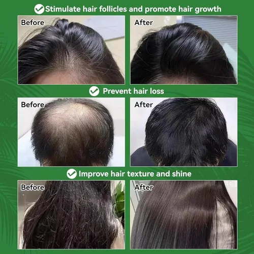Miniatura 5 de AZURE Aceite de batana 100% natural para el crecimiento del cabello, mascarilla orgánica para cabello crudo de Honduras que previene la pérdida