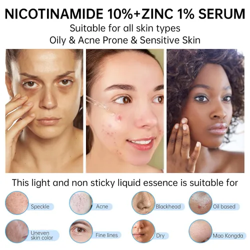 Miniatura 5 de Niacinamida 10%+Zinc 1% Suero Para La Cara, Suero De Niacinamida Para La Cara, Dermatólogo, Alivio De Enrojecimiento-1.0 fl oz 1floz