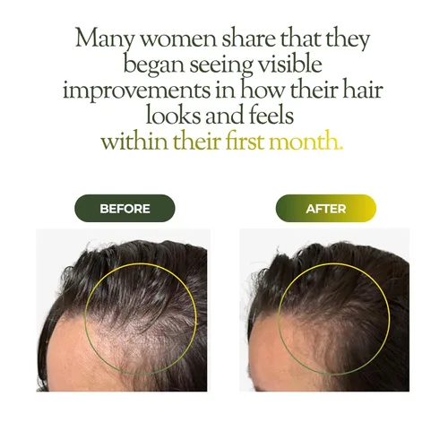 Miniatura 3 de regener8 Aceite para el cabello y el cuero cabelludo para mujeres, mezcla de aceites esenciales y portadores para adelgazamiento y pérdida