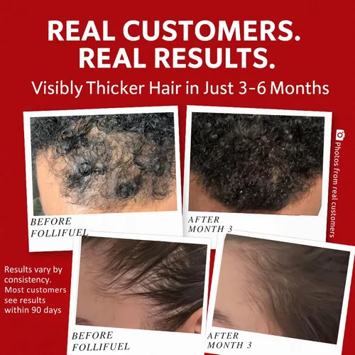 Miniatura 4 de Follifuel - Bebida para el crecimiento del cabello para mujeres y hombres 25 vitaminas para el cabello en 1 cucharada Biotina, Cynatine® HNS