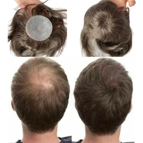 Miniatura 7 de Voloria Parche para el cabello calvo para hombres, 3.15 x 3.15 pulgadas, sistema de reemplazo de cobertura completa de piel de poliuretano