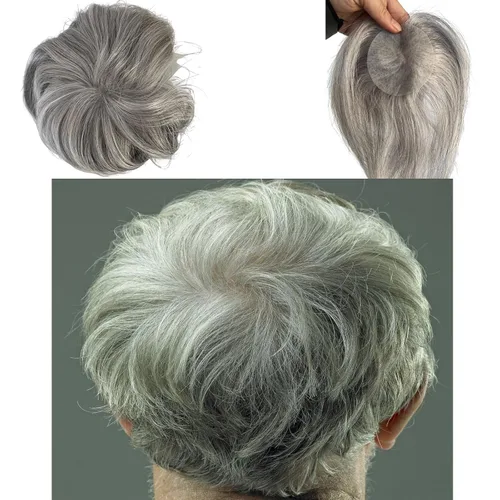 Miniatura 14 de Voloria Parche para el cabello calvo para hombres, 3.15 x 3.15 pulgadas, sistema de reemplazo de cobertura completa de piel de poliuretano