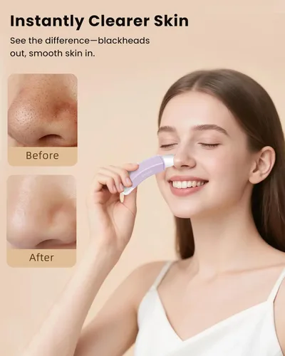 Miniatura 3 de Boloye Herramienta para quitar puntos negros, raspador facial de doble cabeza y limpiador de poros para limpieza facial profunda, raspador de nariz