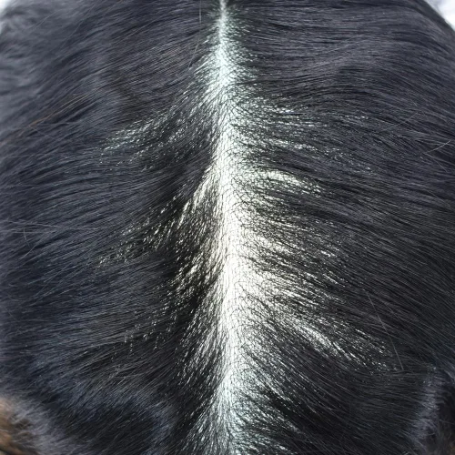 Miniatura 3 de Hair Nature - Tupé para hombres, sistema de repuesto de piezas de cabello humano, unidades de pelo negro con bucle en V de piel fina, 100% cabello