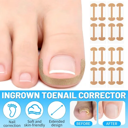 Miniatura 7 de SelfTek Kit de uñas encarnadas – Kit profesional de corrector de uñas encarnadas con tiras transpirables y parches curvos, lima sin dolor