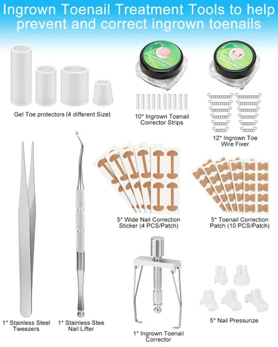 Miniatura 2 de Kit de eliminación de uñas encarnadas, tratamiento de uñas encarnadas, herramientas correctoras de uñas encarnadas vienen con soportes para uñas