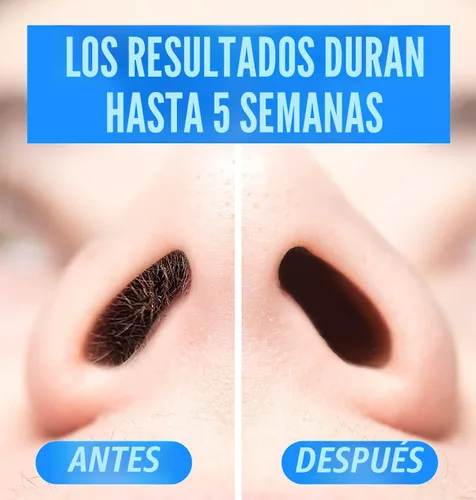 Miniatura 4 de KENASHII Kit de cera nasal 100 g de cera, 24 aplicadores Kit de depilación para hombres y mujeres Incluye toallitas bálsamo y protectores