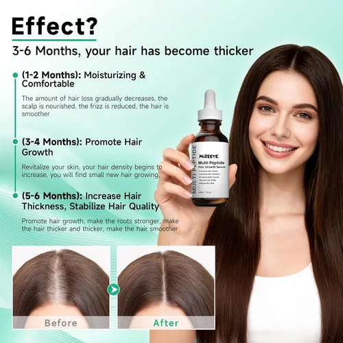 Miniatura 5 de Suero para el crecimiento del cabello para adelgazamiento y encrespamiento, 1.0 fl oz de suero multipéptido vegano y natural para el crecimiento