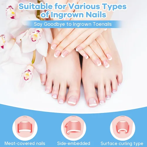 Miniatura 5 de Kit de eliminación de uñas encarnadas con tiras de uñas encarnadas, parche corrector de uñas curvas, lima de uñas y herramientas de pedicura