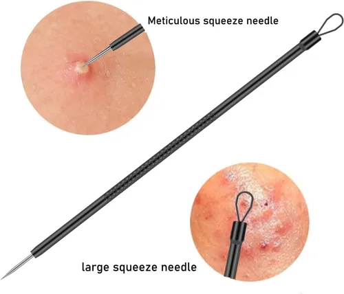 Miniatura 5 de Kit de herramientas para eliminar espinillas, 4 piezas, herramienta extractor de espinillas para nariz y cara, juego de herramientas de eliminación