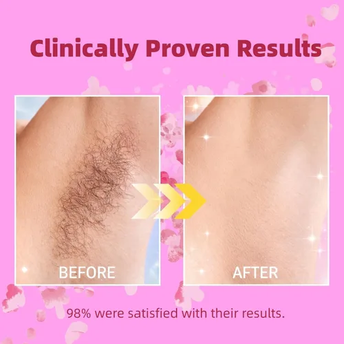 Miniatura 4 de Natural Cyperus Rotundus Oil for Hair Removal, Cyperus Rotundus Oil 60ml, Reduces Unwanted Hair Growth, Moisturizing & Soothing CyperusOil for