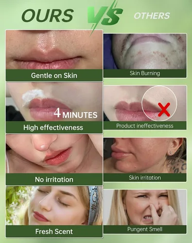 Miniatura 4 de Crema de depilación facial sin dolor para mujeres - Kit 2 en 1 con crema calmante para piel sensible Removedor de vello de labio superior