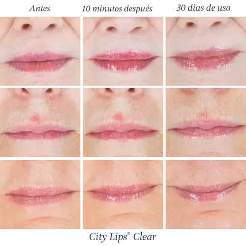 Miniatura 4 de City Beauty City Lips Clear - Brillo de labios voluminizador - Hidrata y volumiza - Voluminizador de labios de alto brillo - Ácido hialurónico