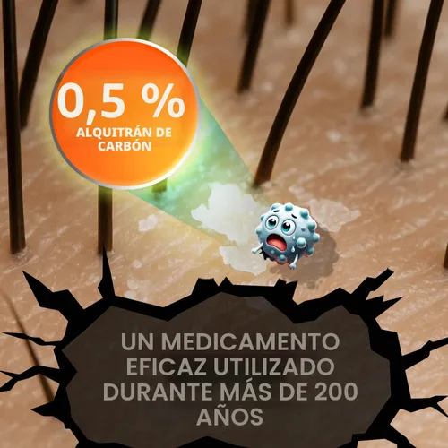 Miniatura 7 de MEDICASP Shampoo anticaspa con alquitrán de hulla, Trata la caspa, dermatitis seborreica y psoriasis, 6 onzas líquidas