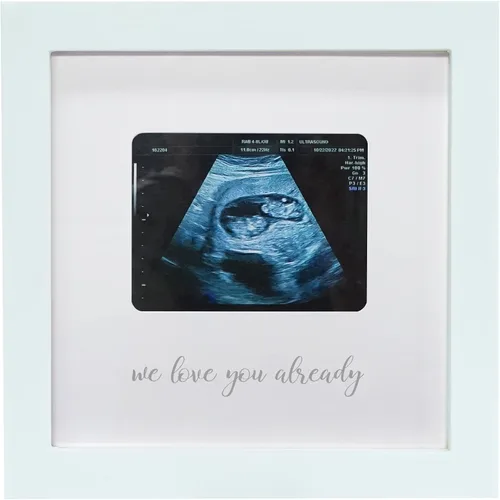 Miniatura 8 de Sonogram - Marco de fotos para abuela, marco de fotos de ultrasonido, anuncio de embarazo para abuela, ideas de anuncio de bebé, marco de fotos