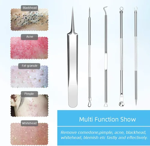 Miniatura 2 de Mejor removedor de puntos negros, eliminación de imperfecciones de puntos negros, kit de eliminación de puntos blancos de acné, herramienta