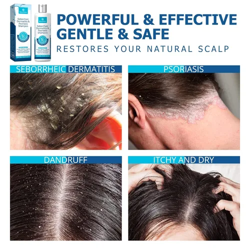 Miniatura 6 de Roycederm Psoriasis, champú para dermatitis seborreica y gel de ducha refrescante CoolDefense