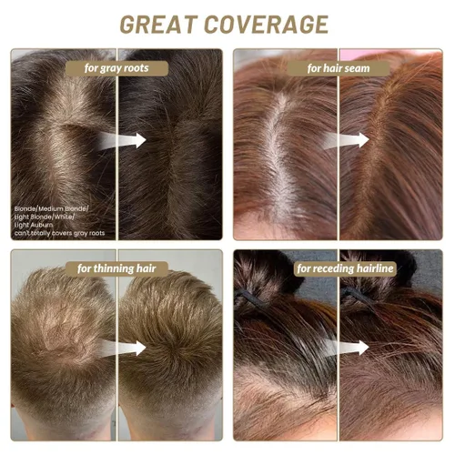 Miniatura 3 de SOVONCARE Polvo de línea capilar – Retoque de raíces y corrector de cabello gris para hombres y mujeres, cubre instantáneamente el cabello 4-rojo